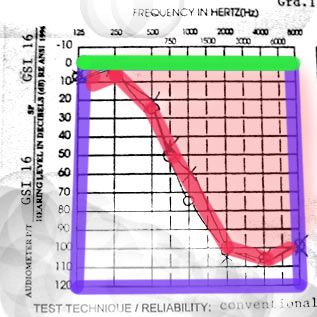 Mel's audiogram